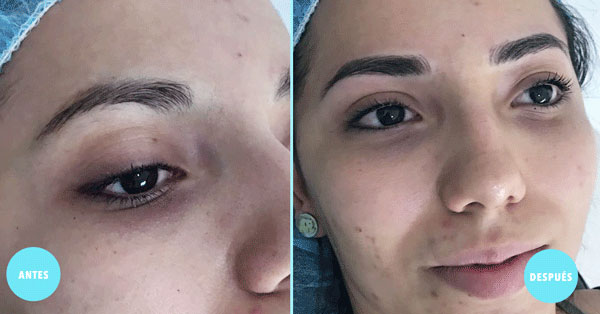 Microblading de Cejas Colima | Antes y Despues